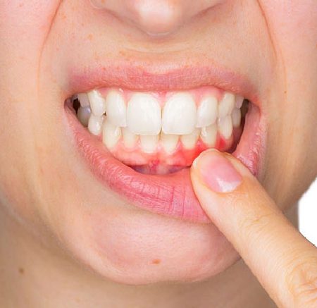 Santé des dents